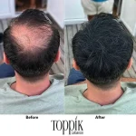 ⁦عرض عبوتين toppik hairfibers لفرغات الشعر الاسود⁩ - الصورة ⁦4⁩